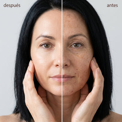 Base Anti-edad Gloomu™
